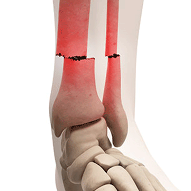 Trauma and Accident Surgery